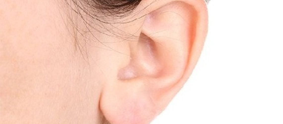 cirurgia-de-estapedectomia